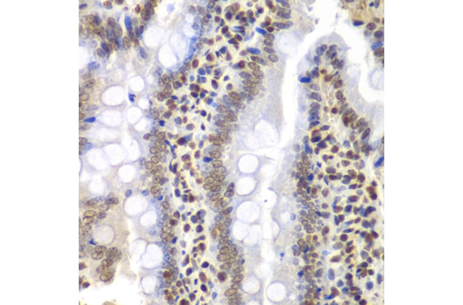 Immunohistochemistry - Anti-TBP-1 Antibody (A13790) - Antibodies.com