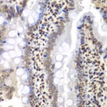 Immunohistochemistry - Anti-TBP-1 Antibody (A13790) - Antibodies.com