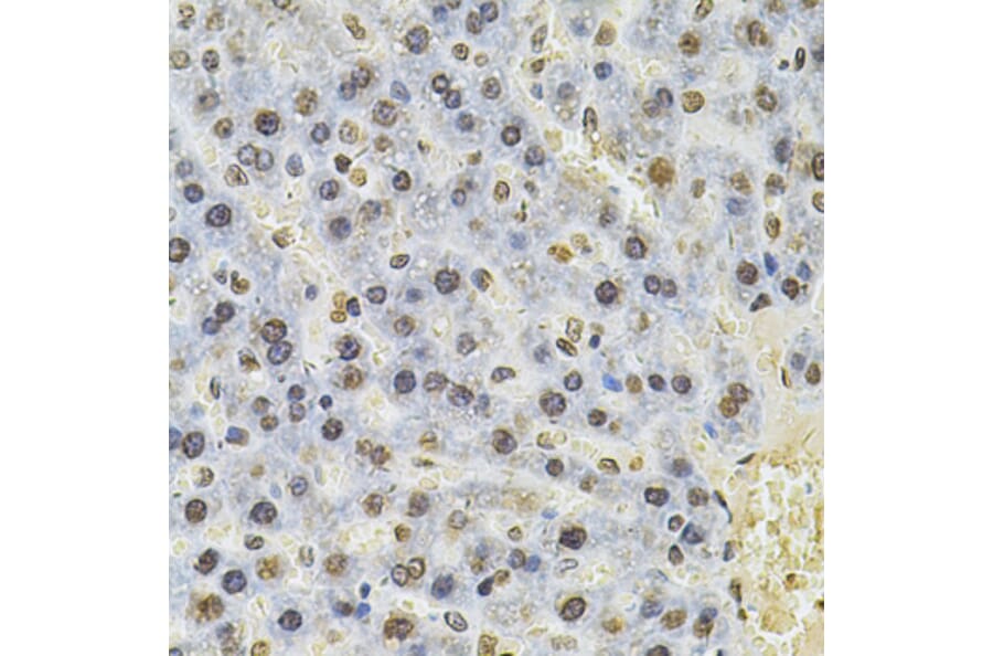 Immunohistochemistry - Anti-TBP-1 Antibody (A13790) - Antibodies.com