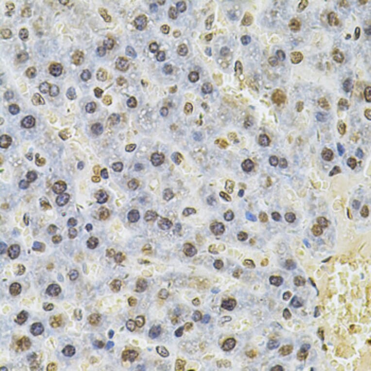 Immunohistochemistry - Anti-TBP-1 Antibody (A13790) - Antibodies.com