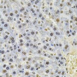 Immunohistochemistry - Anti-TBP-1 Antibody (A13790) - Antibodies.com