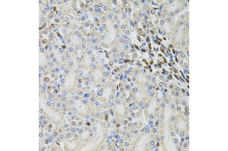 Immunohistochemistry - Anti-TBP-1 Antibody (A13790) - Antibodies.com
