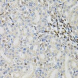 Immunohistochemistry - Anti-TBP-1 Antibody (A13790) - Antibodies.com