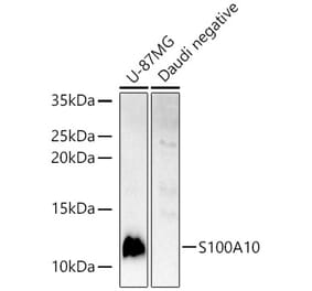 Western Blot - Anti-S100A10 Antibody (A13791) - Antibodies.com