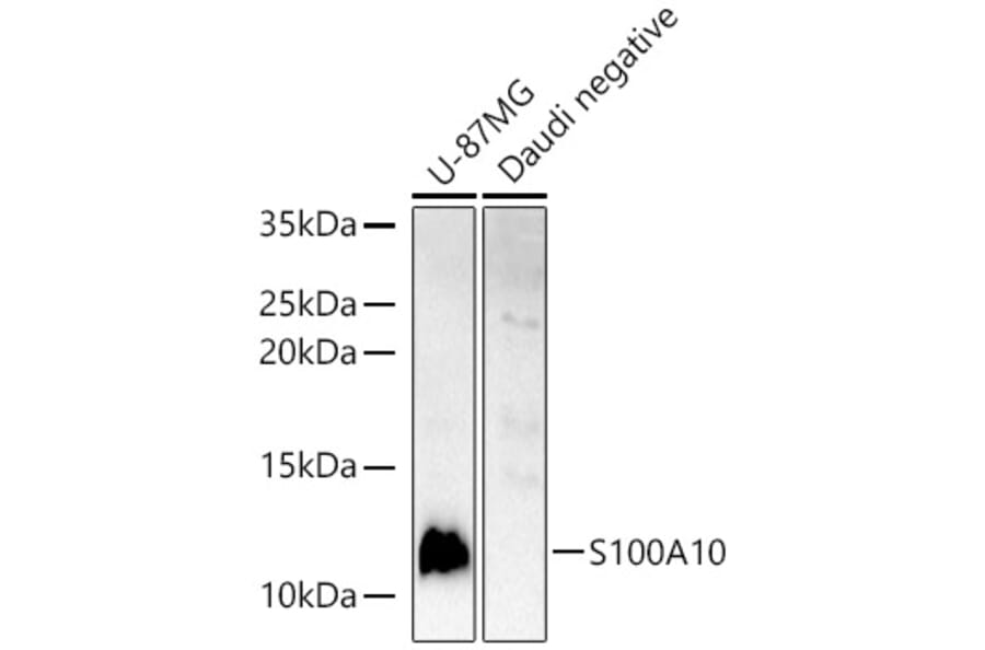 Western Blot - Anti-S100A10 Antibody (A13791) - Antibodies.com