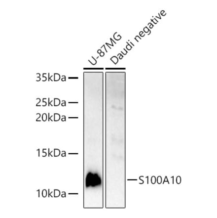 Western Blot - Anti-S100A10 Antibody (A13791) - Antibodies.com
