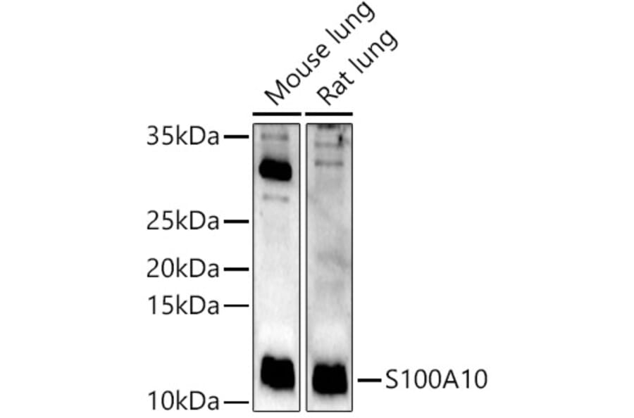 Western Blot - Anti-S100A10 Antibody (A13791) - Antibodies.com