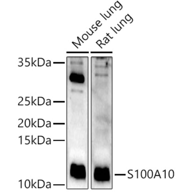 Western Blot - Anti-S100A10 Antibody (A13791) - Antibodies.com