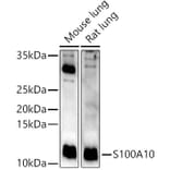 Western Blot - Anti-S100A10 Antibody (A13791) - Antibodies.com