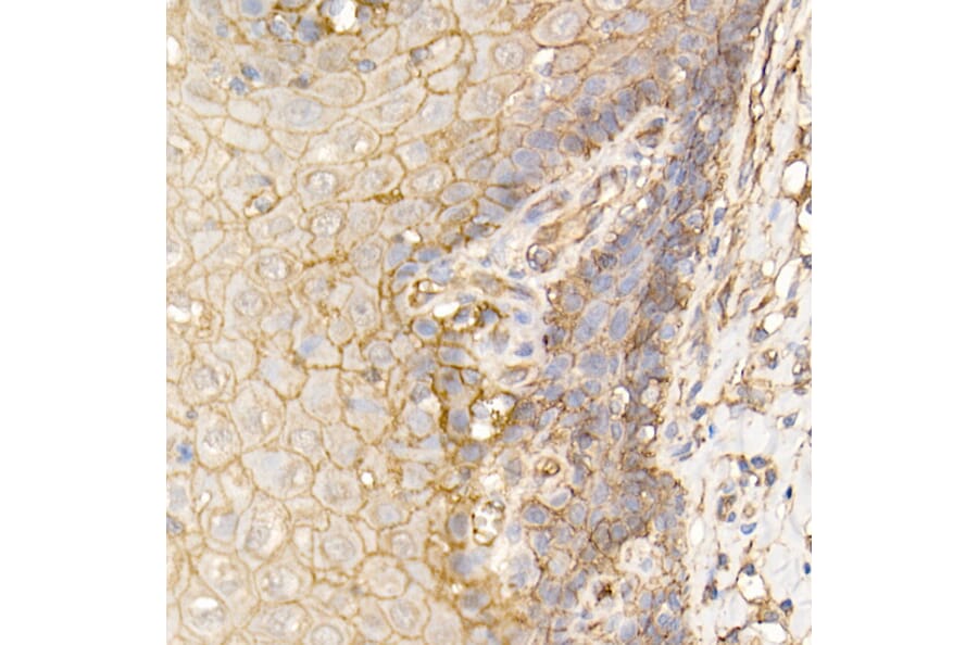 Immunohistochemistry - Anti-S100A10 Antibody (A13791) - Antibodies.com