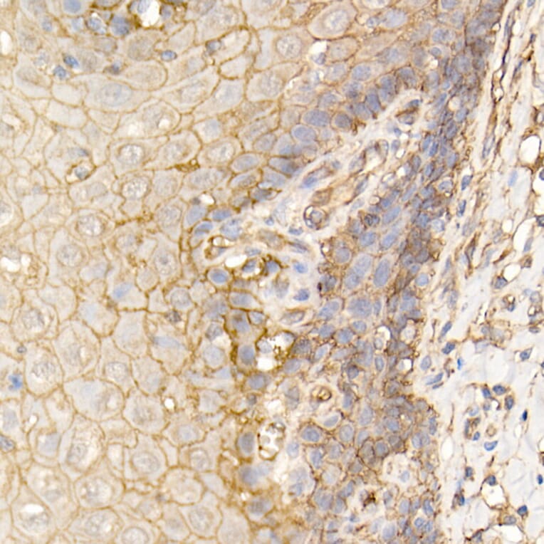 Immunohistochemistry - Anti-S100A10 Antibody (A13791) - Antibodies.com