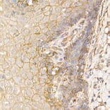 Immunohistochemistry - Anti-S100A10 Antibody (A13791) - Antibodies.com