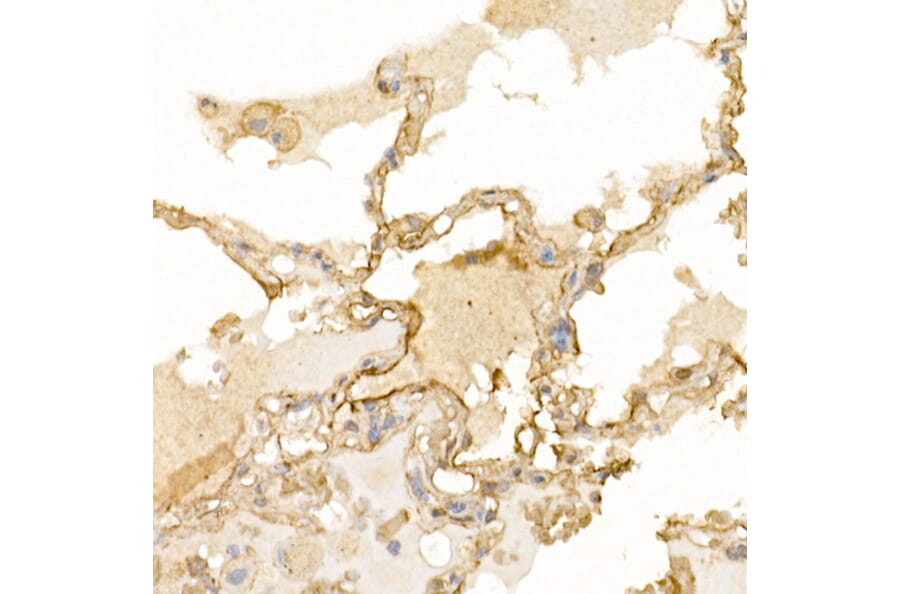 Immunohistochemistry - Anti-S100A10 Antibody (A13791) - Antibodies.com