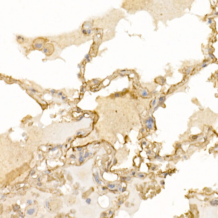 Immunohistochemistry - Anti-S100A10 Antibody (A13791) - Antibodies.com