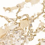 Immunohistochemistry - Anti-S100A10 Antibody (A13791) - Antibodies.com