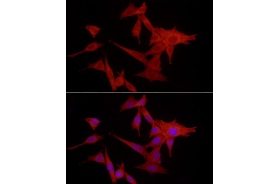 Immunofluorescence - Anti-S100A10 Antibody (A13791) - Antibodies.com