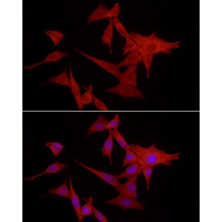 Immunofluorescence - Anti-S100A10 Antibody (A13791) - Antibodies.com