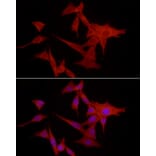 Immunofluorescence - Anti-S100A10 Antibody (A13791) - Antibodies.com