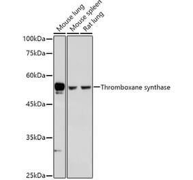 Western Blot - Anti-Thromboxane synthase Antibody (A13792) - Antibodies.com