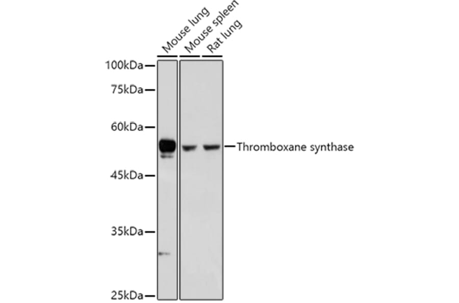 Western Blot - Anti-Thromboxane synthase Antibody (A13792) - Antibodies.com