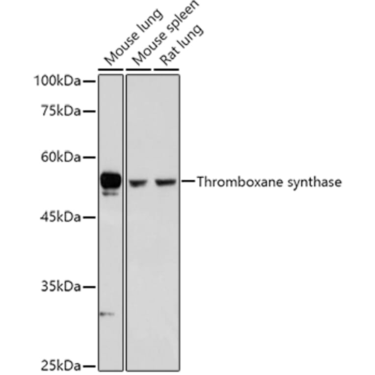 Western Blot - Anti-Thromboxane synthase Antibody (A13792) - Antibodies.com