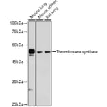 Western Blot - Anti-Thromboxane synthase Antibody (A13792) - Antibodies.com