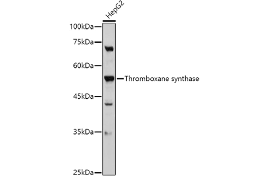 Western Blot - Anti-Thromboxane synthase Antibody (A13792) - Antibodies.com