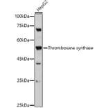 Western Blot - Anti-Thromboxane synthase Antibody (A13792) - Antibodies.com