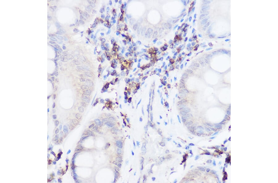 Immunohistochemistry - Anti-Thromboxane synthase Antibody (A13792) - Antibodies.com
