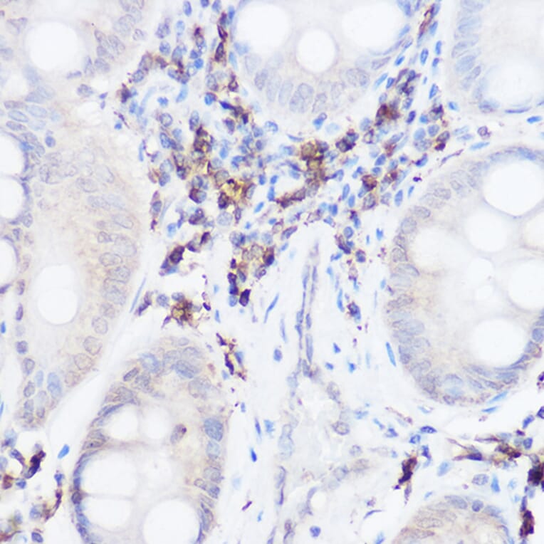 Immunohistochemistry - Anti-Thromboxane synthase Antibody (A13792) - Antibodies.com