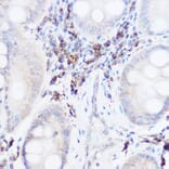 Immunohistochemistry - Anti-Thromboxane synthase Antibody (A13792) - Antibodies.com