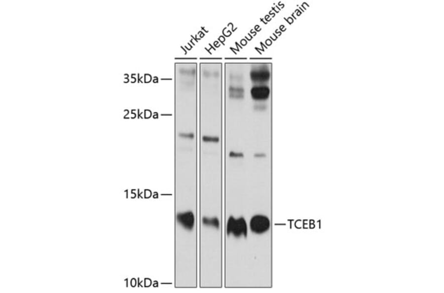 Western Blot - Anti-Elongin-C Antibody (A13793) - Antibodies.com
