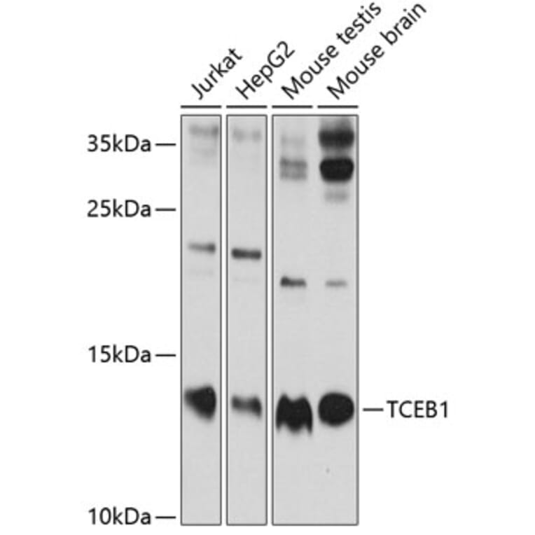 Western Blot - Anti-Elongin-C Antibody (A13793) - Antibodies.com