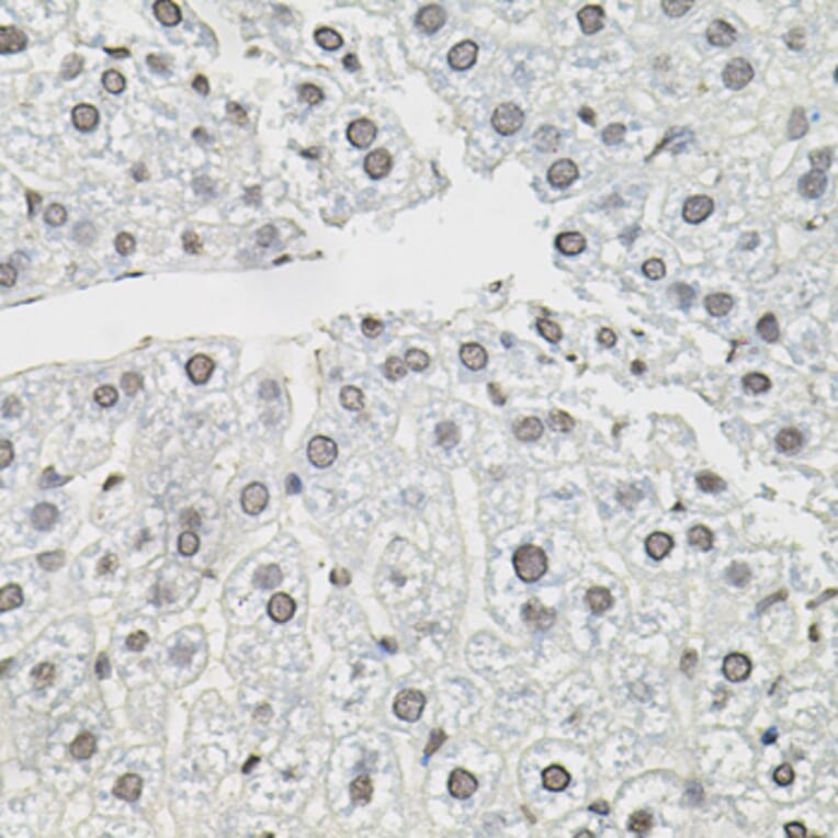 Immunohistochemistry - Anti-Elongin-C Antibody (A13793) - Antibodies.com
