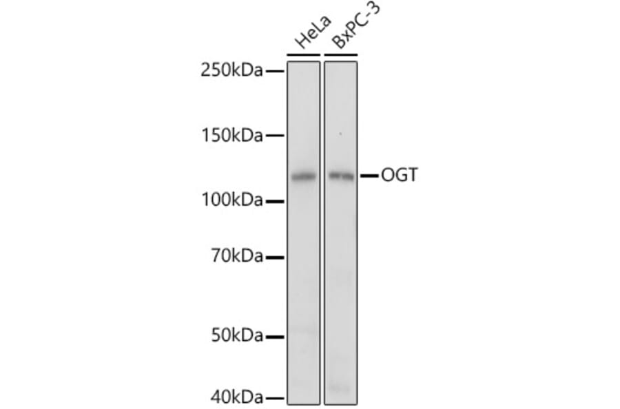 Western Blot - Anti-OGT/O-Linked N-Acetylglucosamine Transferase Antibody (A13794) - Antibodies.com