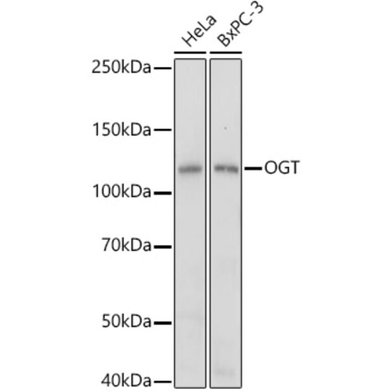 Western Blot - Anti-OGT/O-Linked N-Acetylglucosamine Transferase Antibody (A13794) - Antibodies.com
