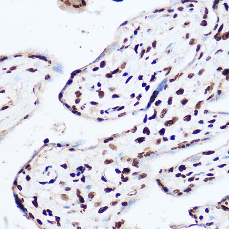 Immunohistochemistry - Anti-OGT/O-Linked N-Acetylglucosamine Transferase Antibody (A13794) - Antibodies.com
