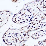 Immunohistochemistry - Anti-OGT/O-Linked N-Acetylglucosamine Transferase Antibody (A13794) - Antibodies.com