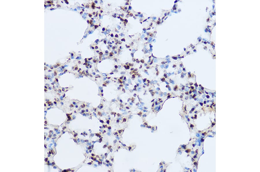 Immunohistochemistry - Anti-OGT/O-Linked N-Acetylglucosamine Transferase Antibody (A13794) - Antibodies.com