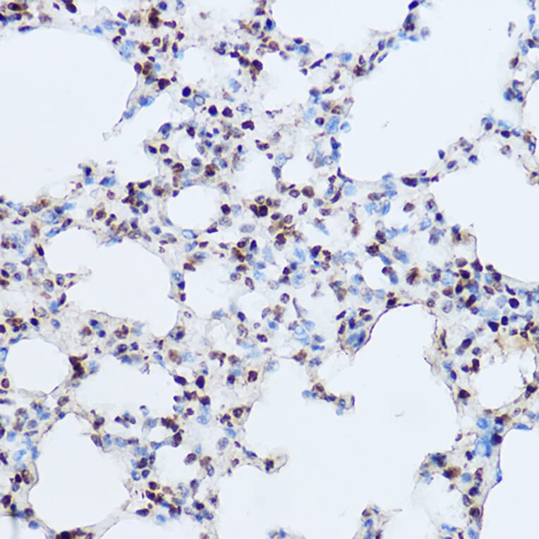 Immunohistochemistry - Anti-OGT/O-Linked N-Acetylglucosamine Transferase Antibody (A13794) - Antibodies.com