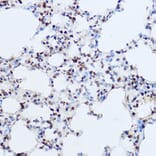 Immunohistochemistry - Anti-OGT/O-Linked N-Acetylglucosamine Transferase Antibody (A13794) - Antibodies.com