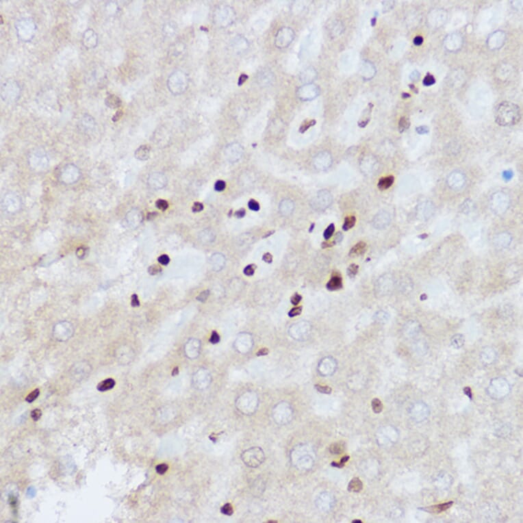 Immunohistochemistry - Anti-OGT/O-Linked N-Acetylglucosamine Transferase Antibody (A13794) - Antibodies.com
