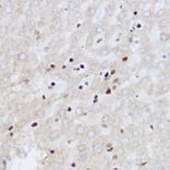 Immunohistochemistry - Anti-OGT/O-Linked N-Acetylglucosamine Transferase Antibody (A13794) - Antibodies.com