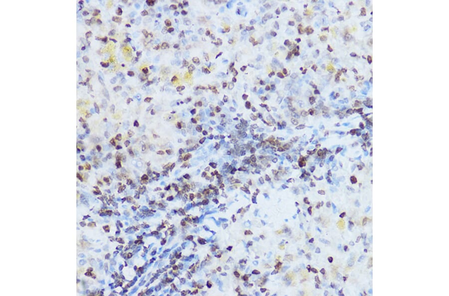 Immunohistochemistry - Anti-OGT/O-Linked N-Acetylglucosamine Transferase Antibody (A13794) - Antibodies.com