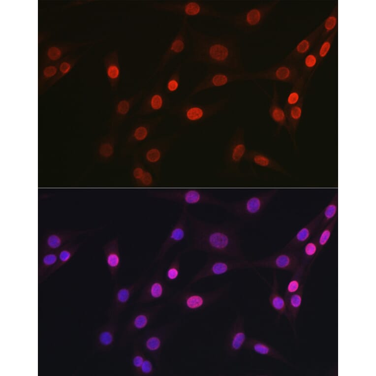 Immunofluorescence - Anti-OGT/O-Linked N-Acetylglucosamine Transferase Antibody (A13794) - Antibodies.com