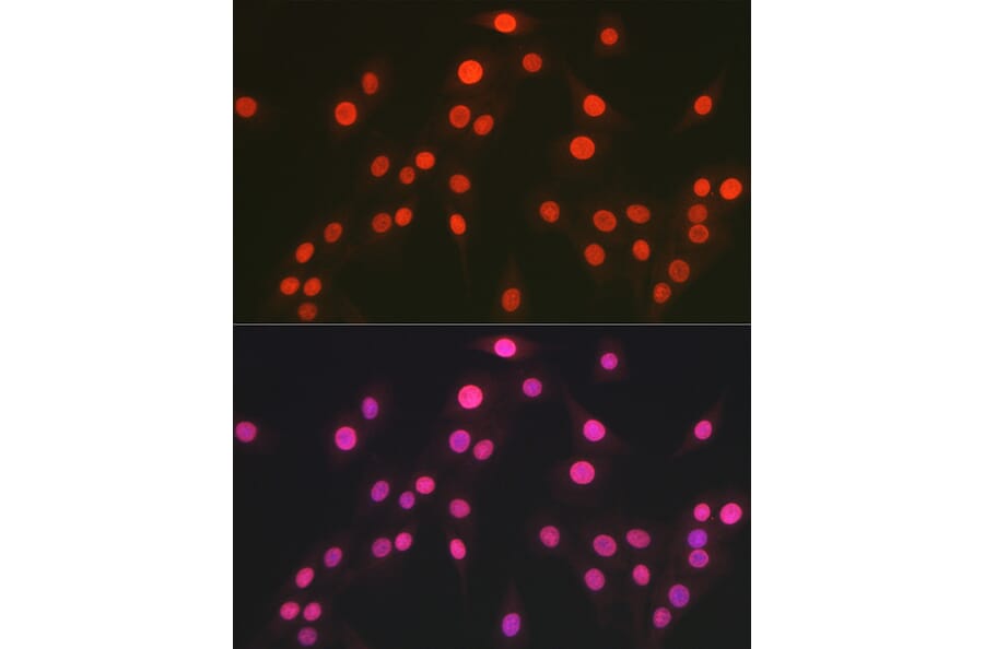 Immunofluorescence - Anti-OGT/O-Linked N-Acetylglucosamine Transferase Antibody (A13794) - Antibodies.com