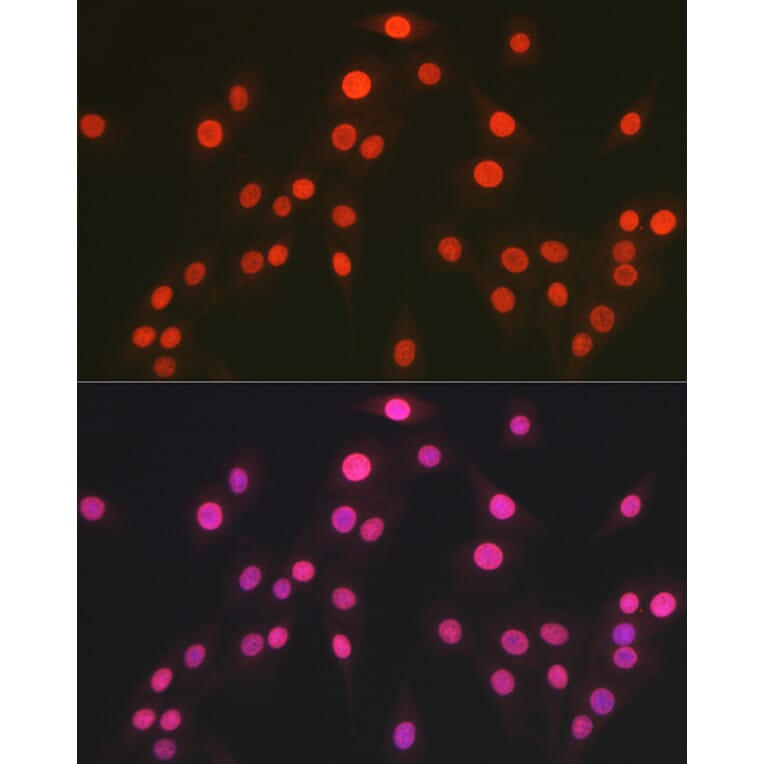 Immunofluorescence - Anti-OGT/O-Linked N-Acetylglucosamine Transferase Antibody (A13794) - Antibodies.com