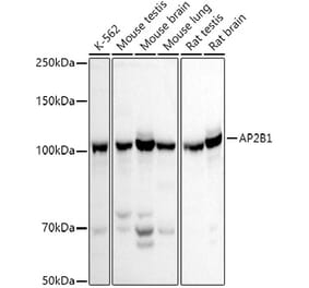 Western Blot - Anti-AP2B1 Antibody (A13795) - Antibodies.com