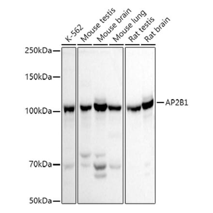 Western Blot - Anti-AP2B1 Antibody (A13795) - Antibodies.com