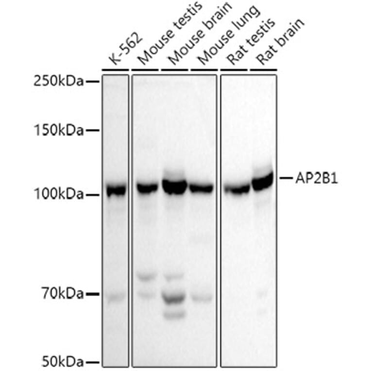 Western Blot - Anti-AP2B1 Antibody (A13795) - Antibodies.com